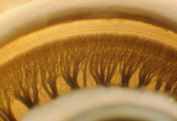 As células ciliadas danificadas podem ser recuperadas?