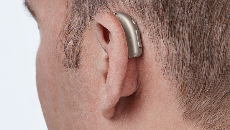 Perda auditiva neurossensorial: o que é, como age e como os aparelhos auditivos ajudam